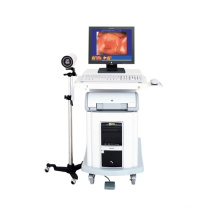 Gynaecology Vagina Diagnostic Trolley Digital Electronic Colposcope